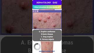 Cutaneous Signs and Diagnosis Quiz  Part 1 medicalmcqs dermatologyquiz [upl. by Brennen562]