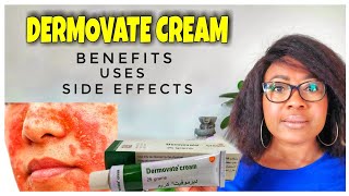 WHY DERMOVATE CREAM SHOULDNT BE USED FOR SKIN WHITENINGBENEFITS SIDE EFFECTS [upl. by Ahsek]