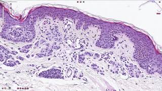 Complete Melanin Biosynthesis Pathway  Eumelanin amp Pheomelanin [upl. by Candis]