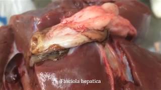 Fasciola hepatica in sheep liver [upl. by Cocks517]