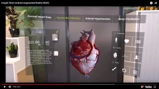 Insight Heart App  Augmented Reality Android App DEMO [upl. by Beghtol]