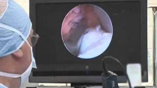 Equine Arthroscopic Surgery [upl. by Llegna464]