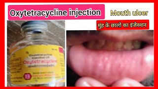 Oxytoxin injection l mouth ulcer l मुंह के छालो का इंजेक्शन l Oxytetracycline injection use in hindi [upl. by Baker401]