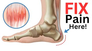 4 Exercises to Fix Achilles Tendonitis FAST [upl. by Matthei]