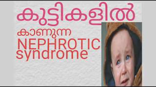 കുട്ടികളിൽ ഉണ്ടാകുന്ന കിഡ്നി പ്രശ്‌നമായ NEPHROTIC syndrome [upl. by Hermione]