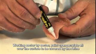 Deflex flexible dentures Video 9 Relines with acrylic [upl. by Ystap]