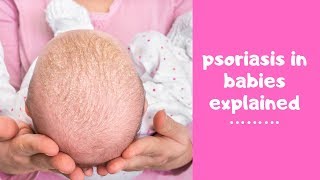 What is psoriasis and how does it affect babies Childs Farm dermatologist reveals all ad [upl. by Aipmylo445]