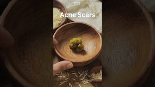 1Minute Recipe Spot Treatment for Acne Scars Ancient Ayurvedic Healing Home Remedy [upl. by Giulietta]