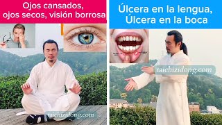 Úlcera en la lengua  Úlcera bucal  Ojos cansados  Ojos secos  Visión borrosa [upl. by Imit850]