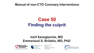 Case 50 PCI Manual  Finding the culprit [upl. by Llerdna]