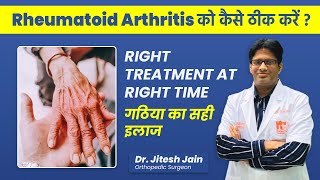 Rheumatoid Arthritis Treatment in Hindi  Osteoarthritis vs Rheumatoid Arthritis  Dr Jitesh Jain [upl. by Ytissac]