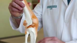 What is Runner’s Knee  Pain in knee when walking  Runners Knee Pain [upl. by Swagerty536]