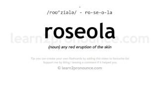 Pronunciation of Roseola  Definition of Roseola [upl. by Fuld213]