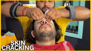 Intense Hair Cracking Head Massage  Skin Cracking by SHAMBOO💈asmr [upl. by Milly530]