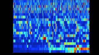 SCHIZOPHRENIA AS SOUND listening to the dynamic brain [upl. by Rhee]