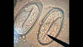 enterobius vermicularis With larva [upl. by Center]