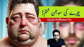 Dr ZeeEasiest Way to Fix the Swollen Face Facial Puffiness and Puffy Eyes  डॉक्टर ज़ी [upl. by Corwun]