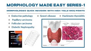 Morphology Series part 1Hashimoto thyroiditisGraves Diseasethyroiditis gravesdiseasemorpholgy [upl. by Quillon]