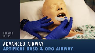 Nursing Skills Oropharyngeal and Nasopharyngeal Airway Insertion [upl. by Einnhoj]