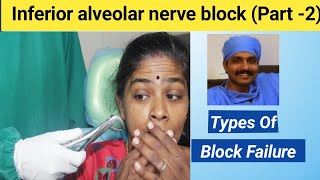 Inferior alveolar nerve block part 2  Types of inferior alveolar nerve block failure [upl. by Gutow]