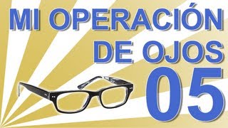 OPERACIÓN DEL SEGUNDO OJO  Experiencia personal operación ojos lentes intraoculares C05 [upl. by Tnattirb]