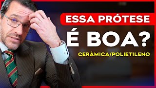 PRÓTESE de cerâmicapolietileno  VALE A PENA [upl. by Ahsaz]