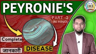 All About Peyronies Disease Homoeopathic medicine for Peyronies diseasepeyroniesdisease [upl. by Mailli411]