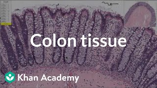 Normal colon tissue  Gastrointestinal system diseases  Health amp Medicine  Khan Academy [upl. by Zindman]