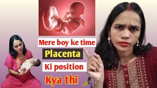 Mere boy ke time placenta ki position kya thi anterior ya posterior 🤰 [upl. by Atsyrhc]