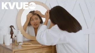 How can you remove head lice [upl. by Jaella]