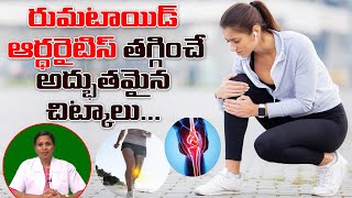 రుమటాయిడ్ ఆర్థరైటిస్ మందులు లేకుండా తగ్గాలంటే  Rheumatoid Arthritis Treatment in Telugu  V Health [upl. by Sibyl]