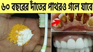 ৬০ বছরের দাঁতের কালো পাথরহলুদ দাগ দূর হবে।দাঁতে পোকাদাঁতে ব্যথামাড়ি সমস্যায় শুধু এটি ব্যবহার করুন [upl. by Malone]