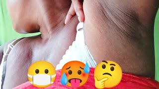 Armpit Blackhead Kaise Remove Kare  waxing video [upl. by Wallis]