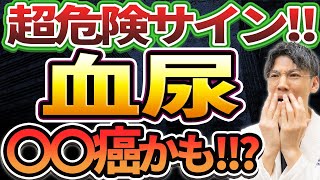 【命の危機】血尿の超恐ろしい原因とは？◯◯癌の可能性があります！！ [upl. by Marra]