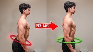 Fix Anterior Pelvic Tilt FAST A Science Based Guide [upl. by Coralyn692]