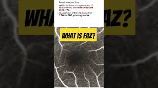 What is foveal vascular zone FAZ in retina retina opthalmology [upl. by Nedrob117]