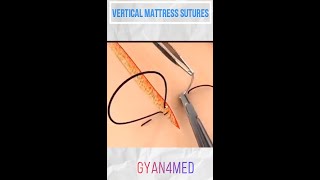 Vertical Mattress Suture  Best Suture Techniques [upl. by Stryker]