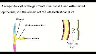 Embryology of vitellointestinal duct  formation fate amp congenital anomalies [upl. by Aerona]