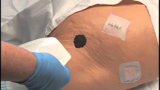 How to apply 3M Tegaderm Pad Film Dressing with NonAdherent Pad [upl. by Schreibman]