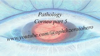 DrElkafrawy Pathology Cornea part5 Other Corneal Depositions [upl. by Euqcaj995]