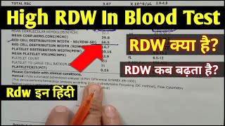 Rdw blood test hindi  High RDW In Blood Test  Rdw test means  Rdw test report [upl. by Sweeney]