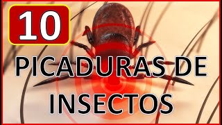 🕷️🚨🐛 10 picaduras De Insectos Que Debes Poder Identificar 🕷️🕷️ algunas son PELIGROSAS ⚠️🚨⚠️ MIRA [upl. by Annaerdna494]