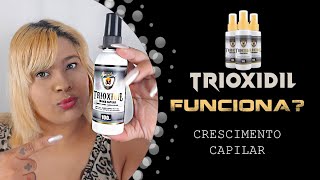 Trioxidil funciona Minha Experiência [upl. by Alegnatal]