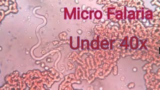 Falaria under 40x microscope [upl. by Kciremed]