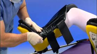 Allen Medical  Allen Stirrups  Instructional Video [upl. by Nav]