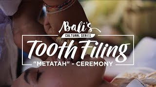 TOOTH FILING quotMETATAHquot CEREMONY BaliGoLiveCulture [upl. by Esor]