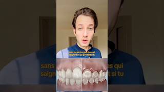 LA VERITÉ SUR LES TACHES APRÈS LES BAGUES DENTAIRES  🦷 dentiste orthodontie appareildentaire [upl. by Nicoline]