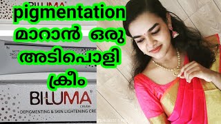 Pigmentation മാറാൻ ഒരു അടിപൊളി ക്രീം All about biluma cream Uses sideeffects skin whitening [upl. by Laamaj]