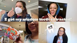 My Experience Getting My Wisdom Teeth Removed Without Sedation [upl. by Maia59]