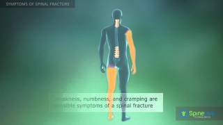 Spinal fracture Symptoms [upl. by Yelekalb741]